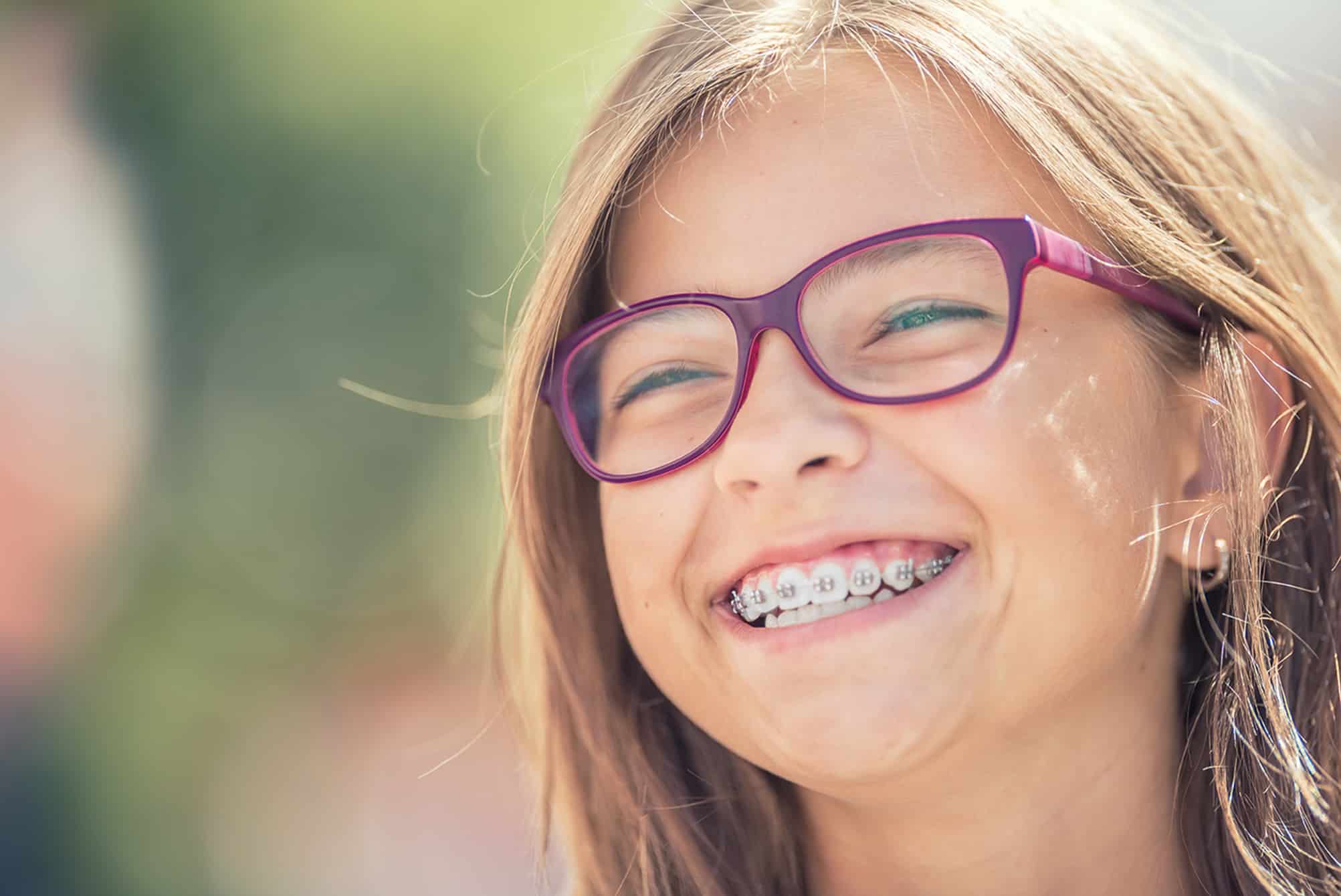 Ceramic Braces in Midland TX - Clear Bracket Braces